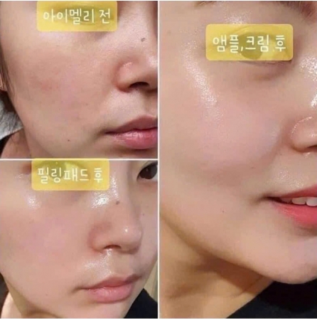 Viên tinh chất dưỡng vitamin, collagen tổng hợp AMMAS MULTI VITA 