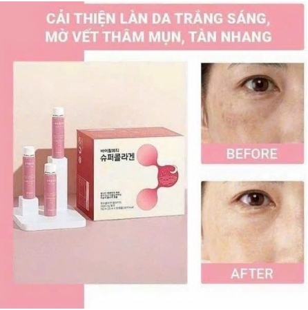 COLLAGEN VB HÀN QUỐC