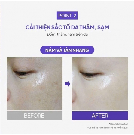 𝑲𝒆𝒎 𝑫𝒖̛𝒐̛̃𝒏𝒈 đ𝒆̂𝒎 𝒔𝒂́𝒏𝒈 𝒅𝒂 𝑴𝒆𝒍𝒂𝒕𝒐𝒏𝒊𝒏 𝑴𝒂𝒙𝒄𝒍𝒊𝒏𝒊𝒄 5% 𝑴𝒂𝒙𝒄𝒍𝒊𝒏𝒊𝒄 