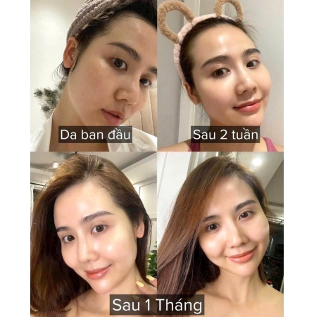 Viên uống Cấp nước Aqua Rich Double Up