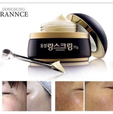 Set kem đặc trị Nám DongSung bản Vip